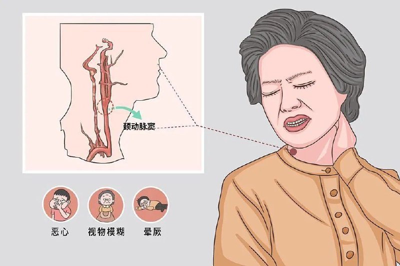 原来穿“高领衣服”难受是一种病为什么高领衣服让人难受？在人体颈部外侧的中部有个颈动脉搏动明显的颈动脉窦，其中丰富的游离神经末梢叫压力感受器，能感知血压变化，并通过神经反射调控心脏和血管的活动，维持心率和血压的稳定