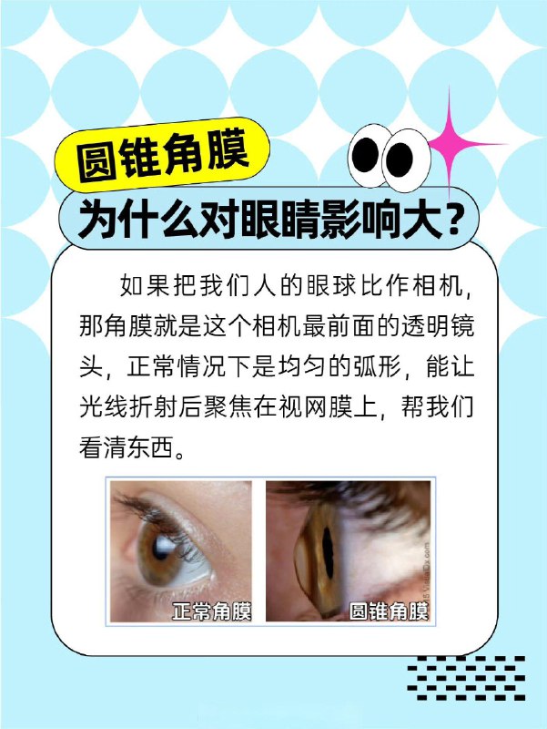 「医学科普：揉眼睛比玩手机更毁眼睛！」「医学科普：揉眼睛比玩手机更毁眼睛！」