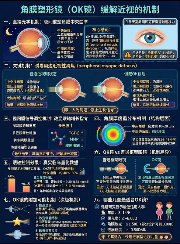 「一图读懂：角膜塑形镜(OK Lenses)&离焦镜（Defocus Spectacle Lenses ）缓解近视机制  」「一图读懂：角膜塑形镜(OK Lenses)&离焦镜（Defocus Spectacle Lenses ）缓解近视机制  」